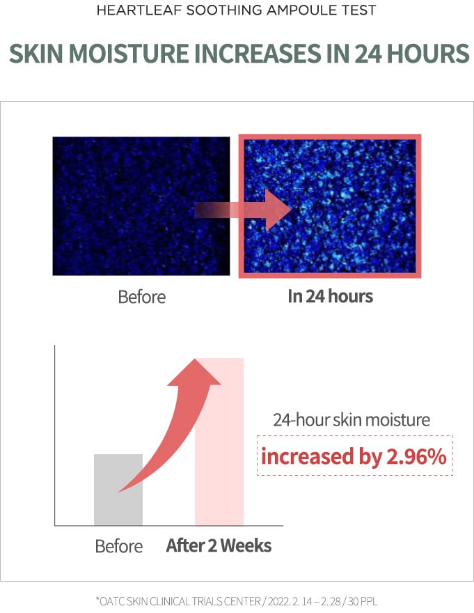 [ANUA] HEARTLEAF 80% SOOTHING AMPOULE 30ML
